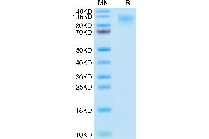 Human MERTK on Tris-Bis PAGE under reduced condition. (MERTK Protein (AA 21-505) (His tag))