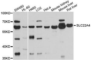 Western blot analysis of extracts of various cells, using SLC22A4 antibody. (SLC22A4 Antikörper)