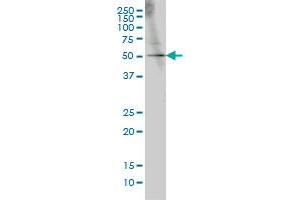 Western Blotting (WB) image for anti-GA Binding Protein Transcription Factor, alpha Subunit 60kDa (GABPA) (AA 1-101) antibody (ABIN598704) (GABPA Antikörper  (AA 1-101))