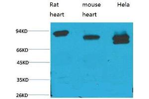 Western Blot (WB) analysis of 1) Rat Heart Tissue, 2)Mouse Heart Tissue, 3) HeLa with STAT3 Mouse Monoclonal Antibody diluted at 1:2000. (STAT3 Antikörper)
