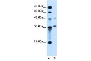 Image no. 2 for anti-Armadillo Repeat Containing, X-Linked 6 (ARMCX6) (AA 64-113) antibody (ABIN205053) (ARMCX6 Antikörper  (AA 64-113))