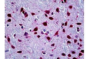 Anti-SFPQ antibody IHC of human brain, cortex. (SFPQ Antikörper  (AA 269-362))