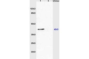 Lane 1: mouse heart lysates Lane 2: mouse liver lysates probed with Anti BAI2/Brain Specific Angiogenesis Inhibitor 2 Polyclonal Antibody, Unconjugated (ABIN872819) at 1:200 in 4 °C. (S1PR3 Antikörper  (AA 145-250))