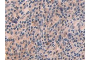Immunohistochemistry (IHC) image for anti-Oncoprotein Induced Transcript 3 (OIT3) (AA 297-506) antibody (ABIN7434002)
