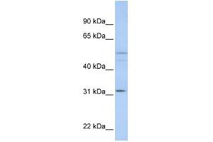 WB Suggested Anti-ZFYVE19 Antibody Titration:  0. (ZFYVE19 Antikörper  (C-Term))