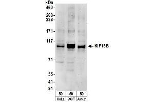 anti-Kinesin Family Member 18B (KIF18B) (AA 802-852) antibody
