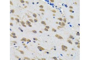 Immunohistochemistry of paraffin-embedded Rat brain using LGR6 Polyclonal Antibody at dilution of 1:100 (40x lens). (LGR6 Antikörper)