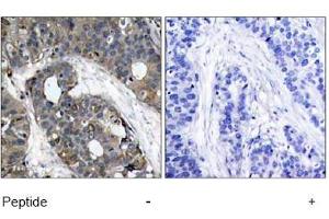 Image no. 1 for anti-Heat Shock 27kDa Protein 1 (HSPB1) (AA 80-84) antibody (ABIN197490) (HSP27 Antikörper  (AA 80-84))