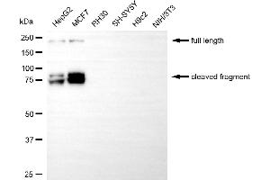 Western blotting analysis using L1 cell adhesion molecule antibody (ABIN7799219). (Rekombinanter L1CAM Antikörper)