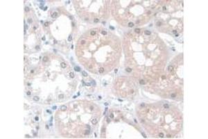 IHC-P analysis of Human Kidney Tissue, with DAB staining. (APOA1 Antikörper  (AA 122-267))