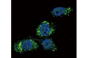 Immunofluorescence testing of human HepG2 cells with GCK antibody (green) and DAPI nuclear counterstain (blue). (GCK Antikörper  (AA 1-30))