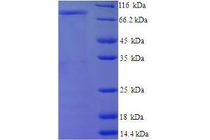 SDS-PAGE (SDS) image for CD44 (CD44) (AA 21-606), (Extracellular), (Isoform 4) protein (His-SUMO Tag) (ABIN5709235) (CD44 Protein (CD44) (AA 21-606, Extracellular, Isoform 4) (His-SUMO Tag))