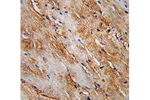 LC3II antibody immunohistochemistry analysis in formalin fixed and paraffin embedded human skeletal muscle.