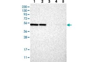 Western blot analysis of Lane 1: RT-4, Lane 2: U-251 MG, Lane 3: Human Plasma, Lane 4: Liver, Lane 5: Tonsil with C2orf30 polyclonal antibody .