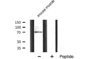 Western blot analysis of p70 S6 Kinase expression in mouse muscle tissue lysates,The lane on the right is treated with the antigen-specific peptide. (RPS6KB1 Antikörper  (Internal Region))