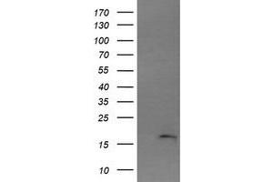 Image no. 1 for anti-Cancer/testis Antigen 1B (CTAG1B) antibody (ABIN1499900) (CTAG1B Antikörper)