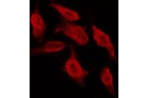 ABIN6267001 staining MCF7 by IF/ICC. (Bcl-2 Antikörper  (Internal Region))