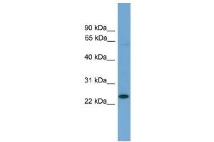 WB Suggested Anti-Ascl3 Antibody Titration: 0.