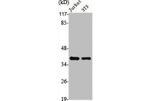 Western Blot analysis of Jurkat NIH-3T3 cells using hnRNP A1 Polyclonal Antibody (HNRNPA1 Antikörper  (Internal Region))