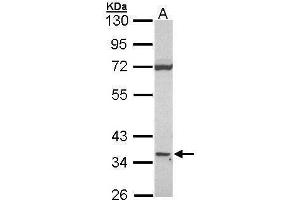 WB Image Sample (30 ug of whole cell lysate) A: Raji 10% SDS PAGE CD1D antibody antibody diluted at 1:1000 (CD1d Antikörper)