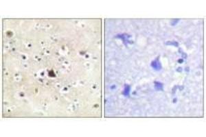 Immunohistochemical analysis of paraffin-embedded human brain tissue using GR (Ab-226) antibody. (Glucocorticoid Receptor Antikörper  (Ser226, Ser234, Ser246))