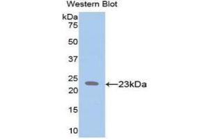 Western Blotting (WB) image for anti-Elastin (ELN) (AA 392-645) antibody (ABIN3201590) (Elastin Antikörper  (AA 392-645))