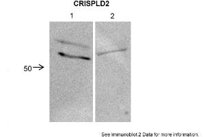 Sample Type: 1. (CRISPLD2 Antikörper  (N-Term))