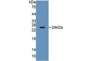 Detection of Recombinant LYPLA2, Human using Polyclonal Antibody to Lysophospholipase II (LYPLA2) (LYPLA2 Antikörper  (AA 1-196))