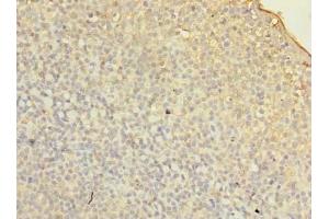 Immunohistochemistry of paraffin-embedded human tonsil tissue using ABIN7153114 at dilution of 1:100 (Formin-Like 1 Antikörper  (AA 207-457))