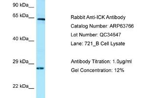 Western Blotting (WB) image for anti-Intestinal Cell (MAK-Like) Kinase (ICK) (C-Term) antibody (ABIN2789615) (ICK Antikörper  (C-Term))