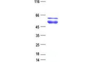 Validation with Western Blot (ZNF641 Protein (His tag))
