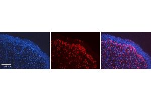 Rabbit Anti-NFE2L2 Antibody   Formalin Fixed Paraffin Embedded Tissue: Human Urinary Bladder Tissue Observed Staining: Cytoplasm, Nucleus Primary Antibody Concentration: 1:600 Other Working Concentrations: N/A Secondary Antibody: Donkey anti-Rabbit-Cy3 Secondary Antibody Concentration: 1:200 Magnification: 20X Exposure Time: 0.