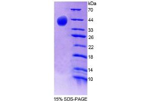 SDS-PAGE (SDS) image for Synapsin II (SYN2) (AA 88-422) protein (His tag) (ABIN4989733)