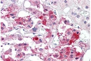 Anti-BAD antibody IHC staining of human adrenal.