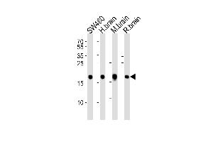 Western blot analysis of lysates from SW480 cell line, human brain, mouse brain and rat brain tissue lysate(from left to right), using VILIP1 Antibody at 1:1000 at each lane. (VSNL1 Antikörper  (C-Term))