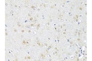 Immunohistochemistry of paraffin-embedded rat brain using RBFOX3 antibody (ABIN1874561) at dilution of 1:100 (40x lens). (NeuN Antikörper)