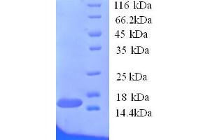 SDS-PAGE (SDS) image for TRAF Family Member-Associated NFKB Activator (TANK) (AA 1-119), (partial) protein (His tag) (ABIN5713870) (TANK Protein (AA 1-119, partial) (His tag))
