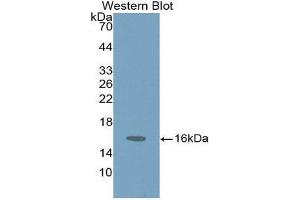 Western Blotting (WB) image for anti-Hexosaminidase B (Beta Polypeptide) (HEXB) (AA 315-456) antibody (ABIN3208196) (HEXB Antikörper  (AA 315-456))