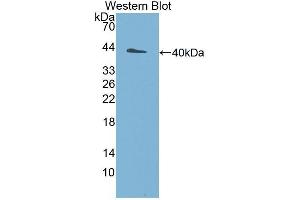 Western Blotting (WB) image for anti-Ubiquitin Protein Ligase E3A (ube3a) (AA 158-407) antibody (ABIN1860894) (ube3a Antikörper  (AA 158-407))