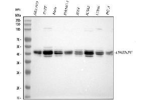 Western blot analysis of HnRNPF using anti-HnRNPF antibody (ABIN4886622). (HNRNPF Antikörper  (N-Term))