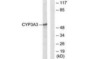 Western blot analysis of extracts from Jurkat cells, using Cytochrome P450 3A4/5 Antibody. (Cytochrome P450 3A4, 3A5 (AA 251-300) Antikörper)