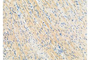 ABIN6258429 and ABIN6274809 at 1/100 staining Rat heart tissue by IHC-P. (LPCAT2 Antikörper  (N-Term))