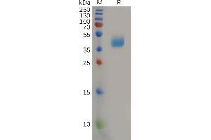 SDS-PAGE (SDS) image for Chemokine (C-C Motif) Receptor 2 (CCR2) (AA 1-42) protein (Fc Tag) (ABIN6964238)