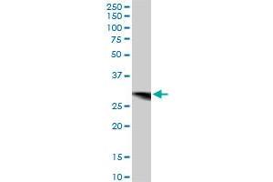 Western Blotting (WB) image for anti-Cytochrome B5 Reductase 3 (CYB5R3) (AA 1-301) antibody (ABIN560603)