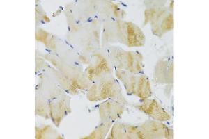 Immunohistochemistry of paraffin-embedded rat skeletal muscle using TRAP1 Antibody (ABIN5971463) at dilution of 1/100 (40x lens).