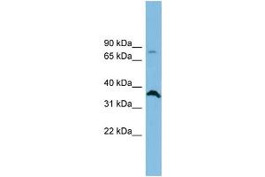 WB Suggested Anti-SLC6A15 Antibody Titration: 0. (SLC6A15 Antikörper  (Middle Region))