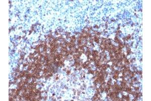 IHC testing of FFPE human tonsil with recombinant CD79a antibody (clone IGA/1790R). (Rekombinanter CD79a Antikörper  (AA 202-216))