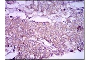 Immunohistochemistry (IHC) image for anti-Glypican 3 (GPC3) antibody (ABIN1107403) (Glypican 3 Antikörper)