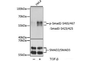 SMAD2 anticorps  (pSer423, pSer425, pSer465, pSer467)