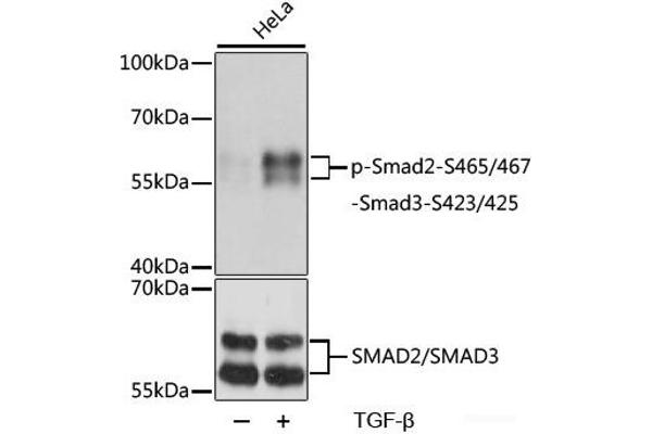 SMAD2 anticorps  (pSer423, pSer425, pSer465, pSer467)